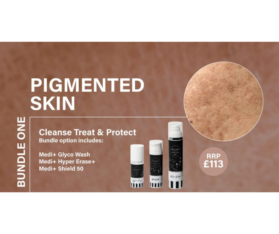 million dollar Pigmentation